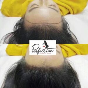 hairline microblading