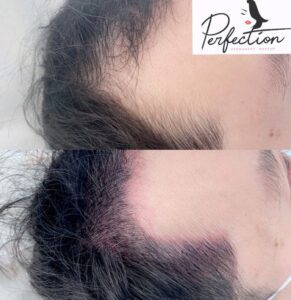 hairline tatto