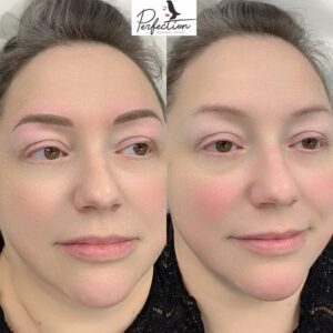 eyebrow micrblading