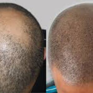 microblading