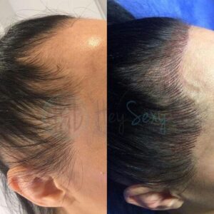 permanent hairline tattoo