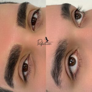 Man brow