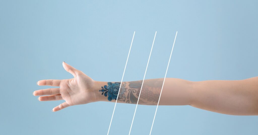 An female arm outstretched with a tattoo on it. The tattoo is fading away in three stages along her arm.