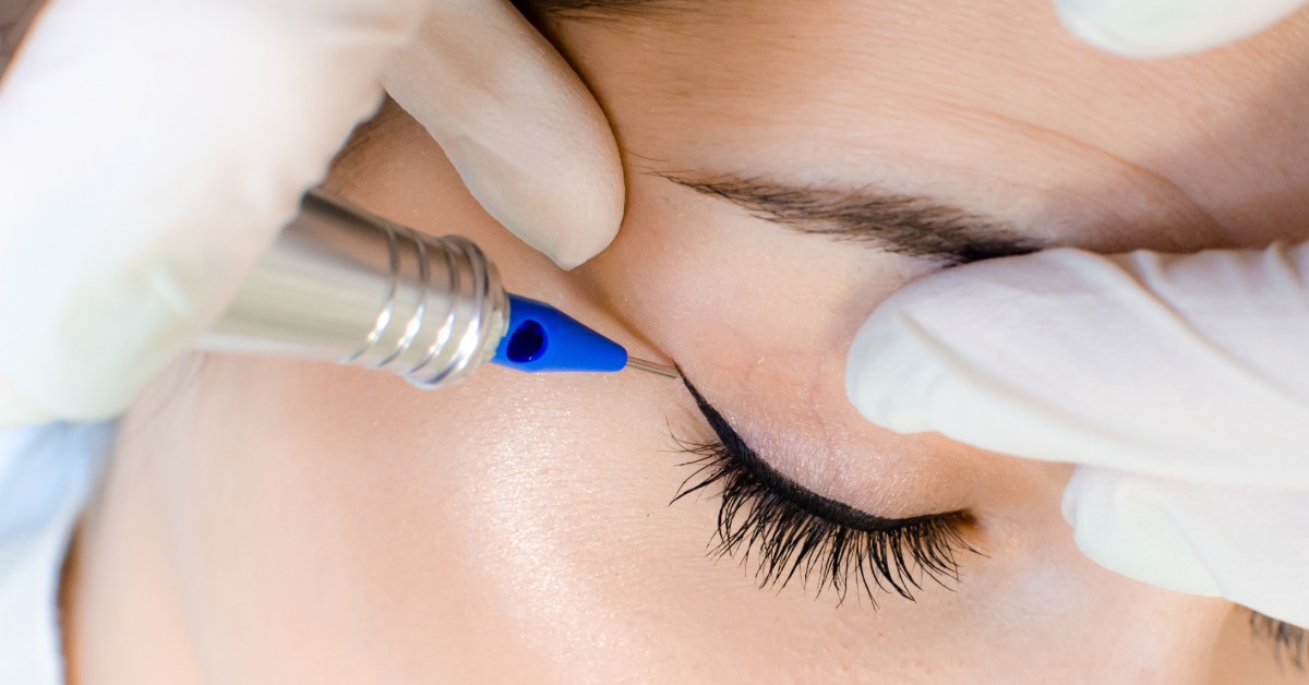A closeup on the gloved hands of a professional makeup artist tattoo an eyeliner tattoo onto a woman's face.